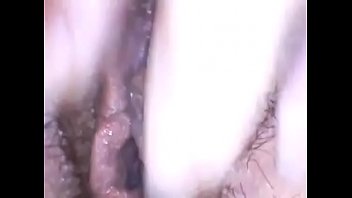 Esplorazione di una bellissima figa pelosa con endoscopio medicale buon divertimento