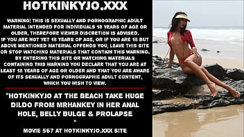 Hotkinkyjo at the beach take huge dildo from mrhankey in her anal hole, belly bulge & prolapse
